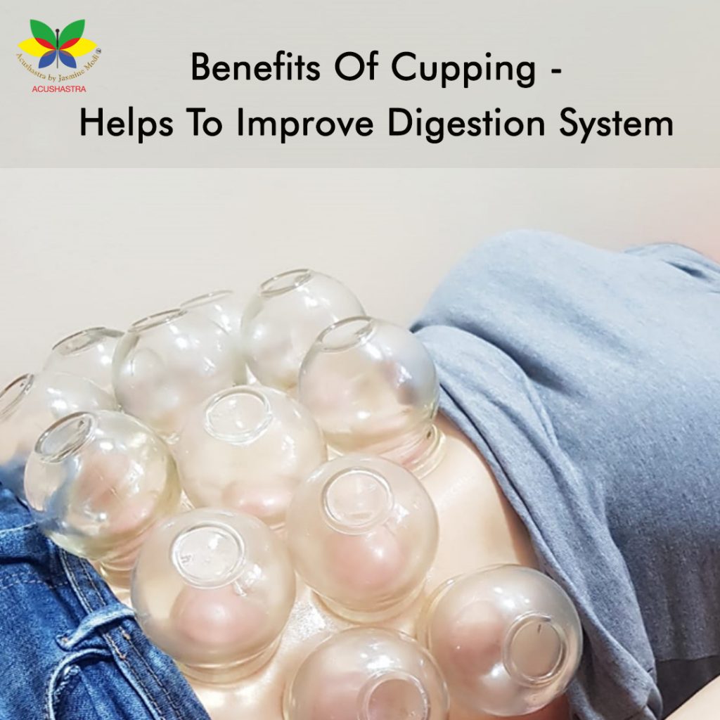 cupping-helps-to-improve-digestive-system