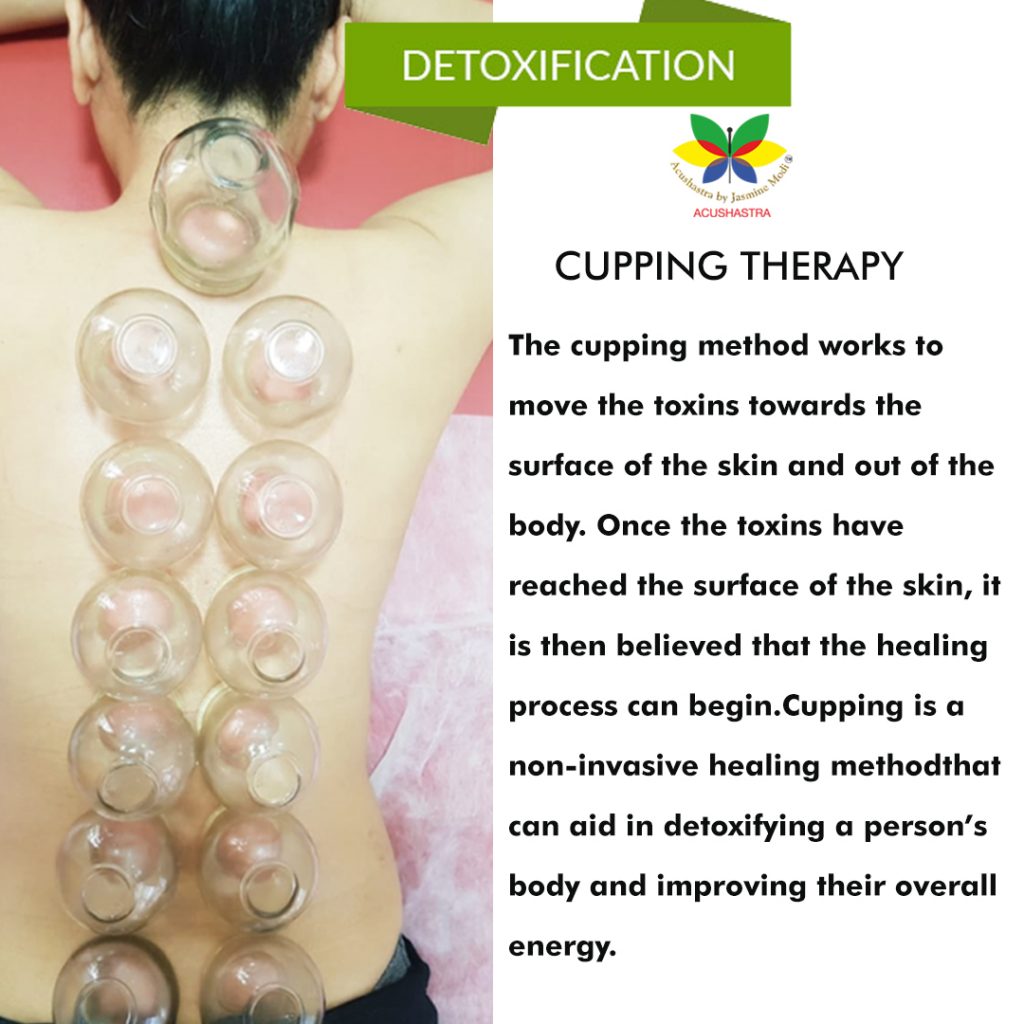Cupping Therapy For Detoxification